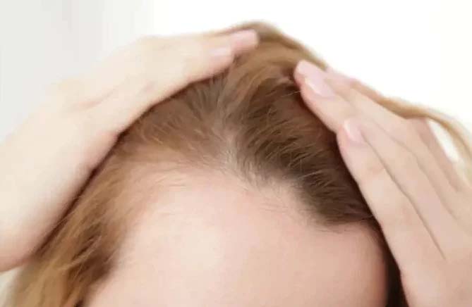 Ursachen für dünner werdendes Haar bei Frauen
