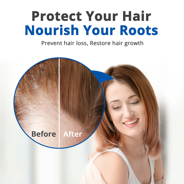 HAIRMETTO topical saw palmetto hair serum, daytime use, leave in to stimulate follicles, block DHT, natural drug-free treatment for hair loss, hair growth thicker