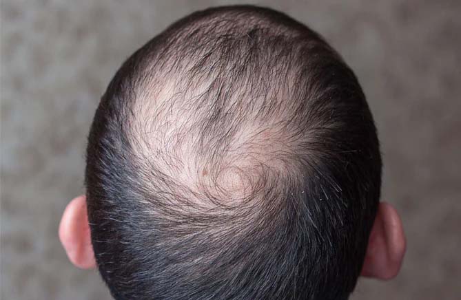 Your Top 3 Scalp-Care-Needs Right Now